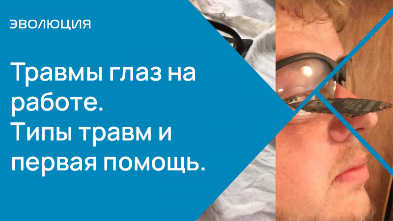 Травмы глаз на работе.